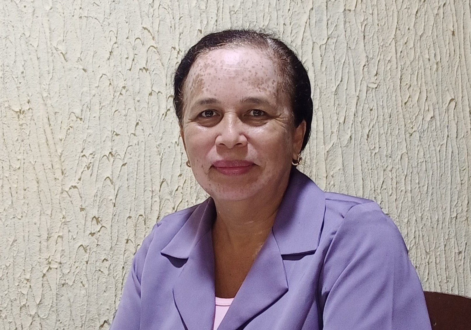 Urimare Contreras 